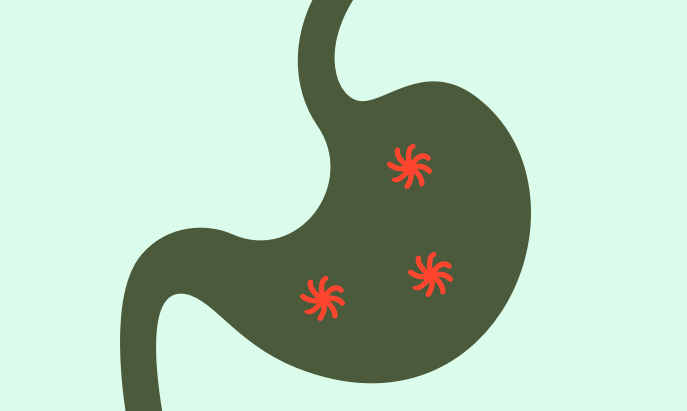 Illustration of a stomach with issues